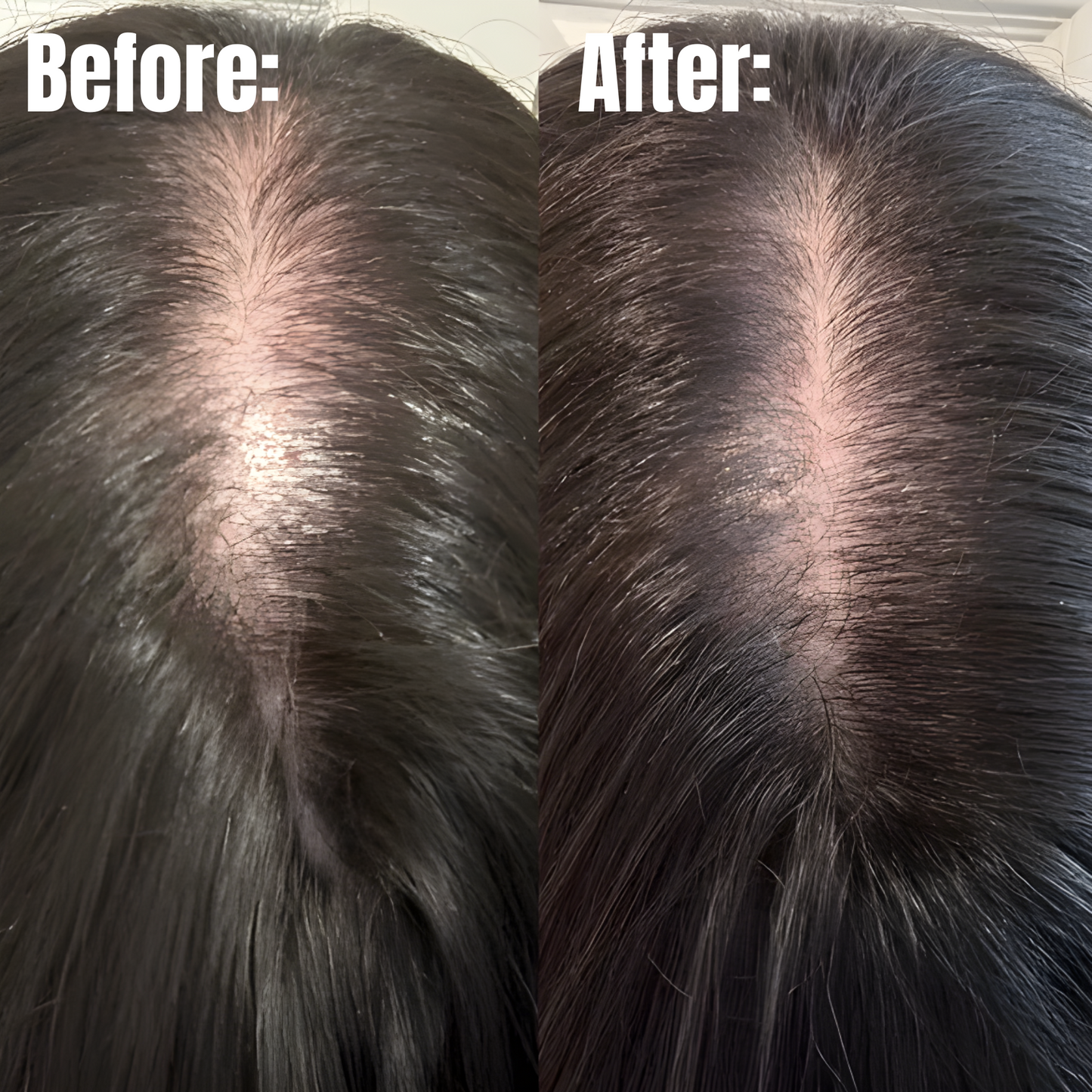 Pumpkin Seed Oil Soft Capsules