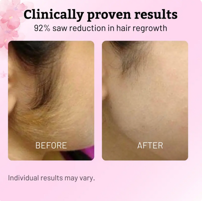 Lorvessa™ Hair Removal Oil